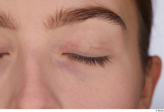 Malin eye 0003.jpg